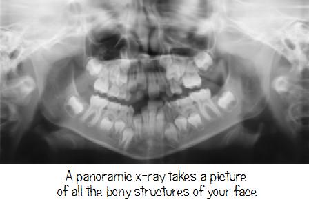 Panoramic x-ray